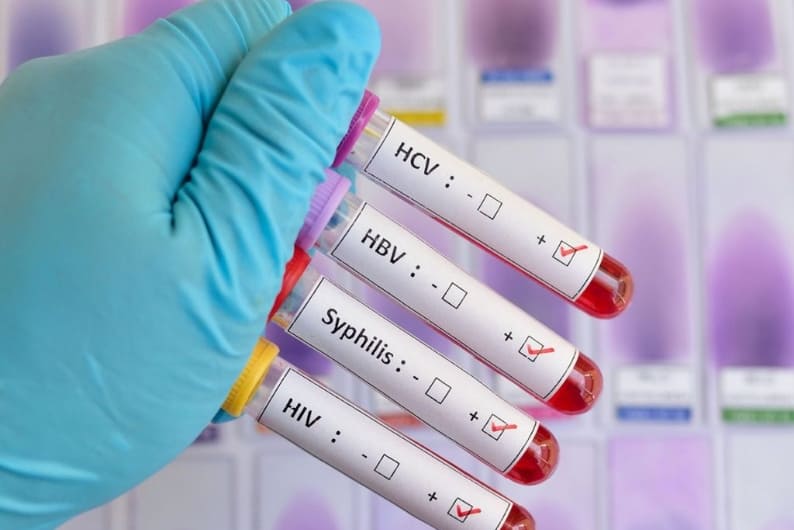 urologo para verrugas genitales